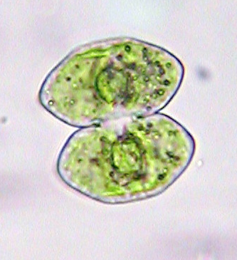 Cosmarium pseudoprotuberans